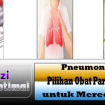 Pneumonia 5 Pilihan Obat Paru-paru untuk Meredakan